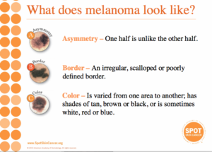 Melanoma Skin Cancer Detection 