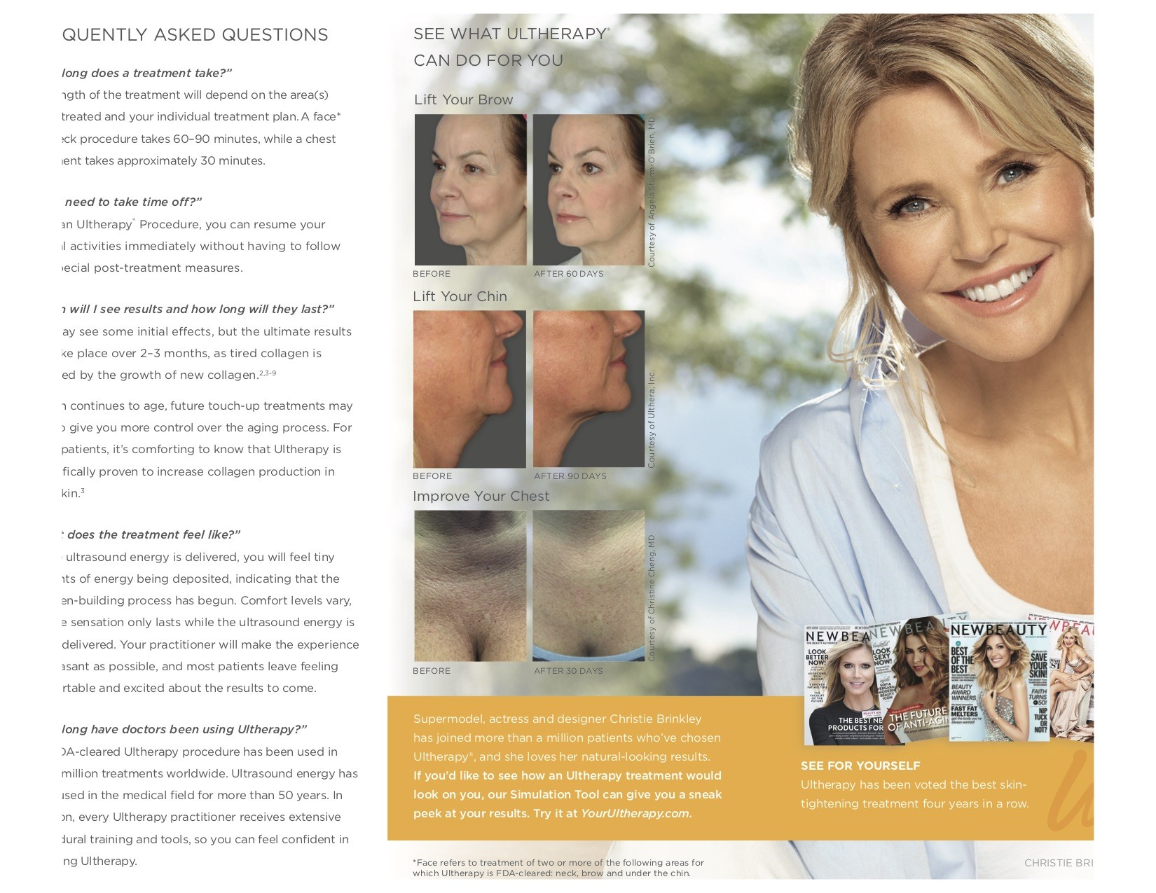 Christie Brinkley Ultherapy Skin Tightening