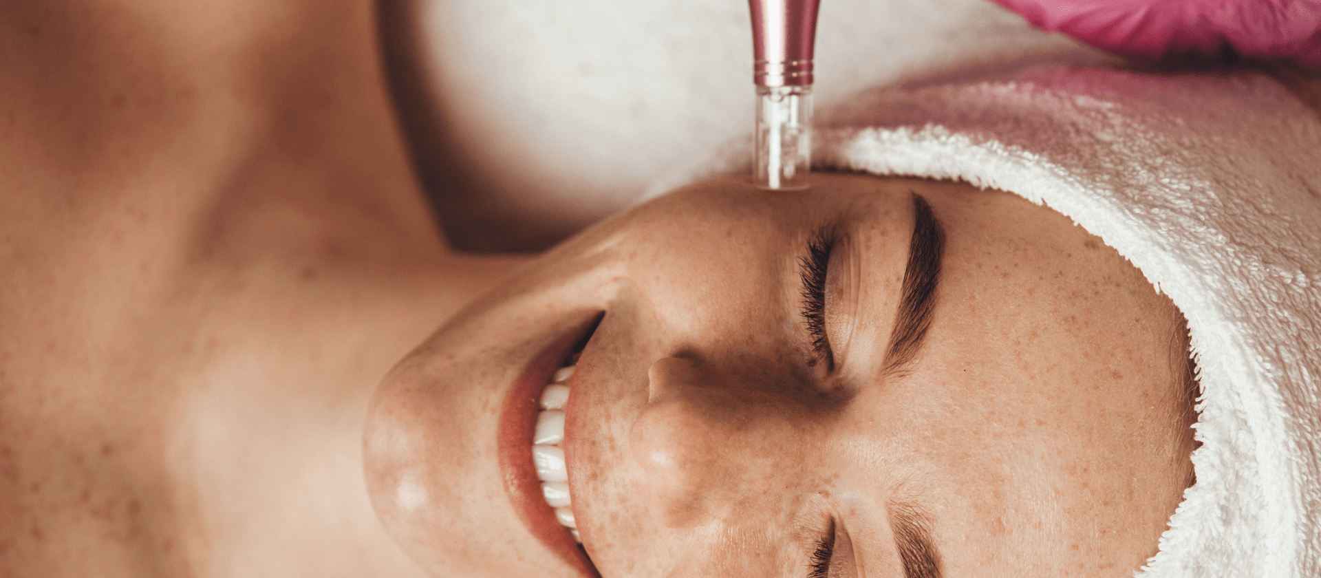 women getting microneedle treatment