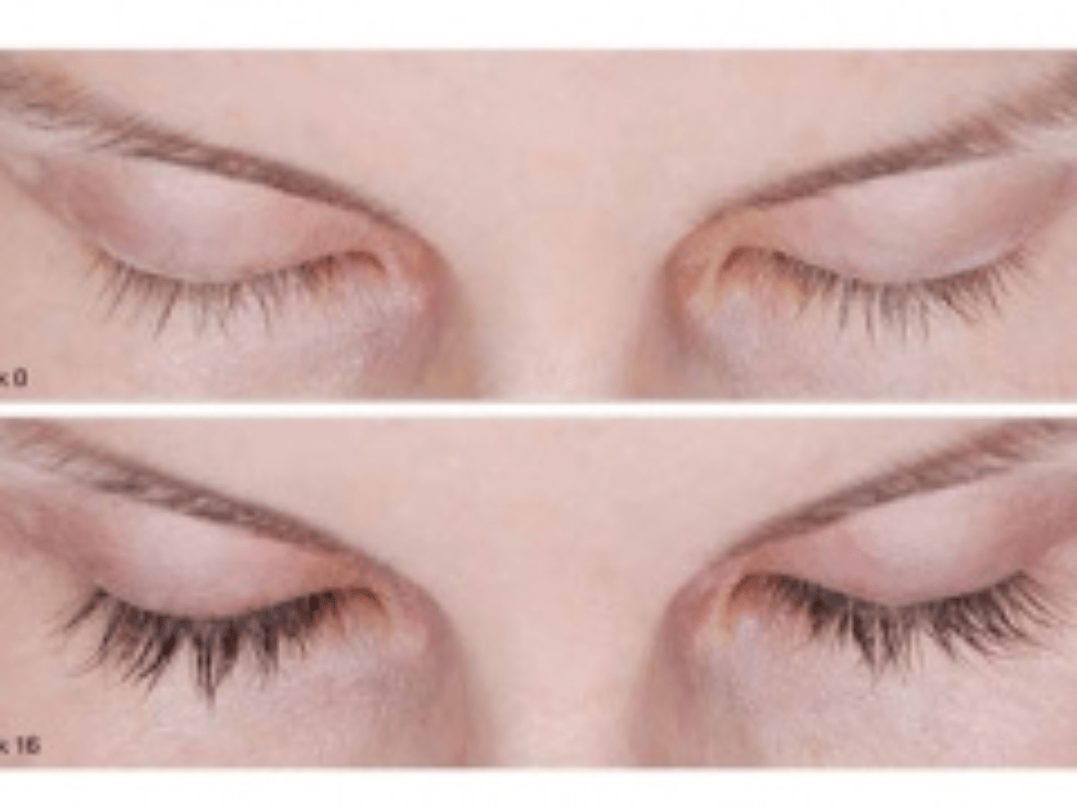 before after eylashes