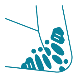 psoriasis on an elbow icon